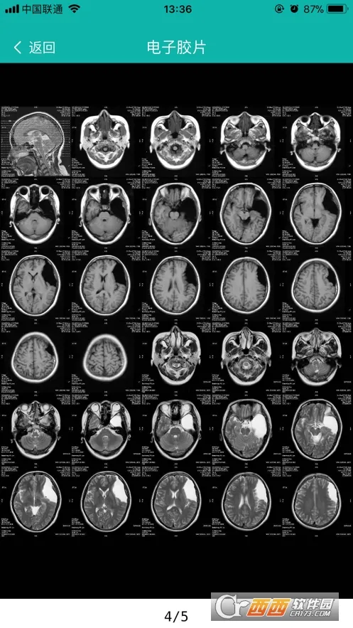 ΢Ӱҽ��(ҽ��Ӱ�����Ӧ��)